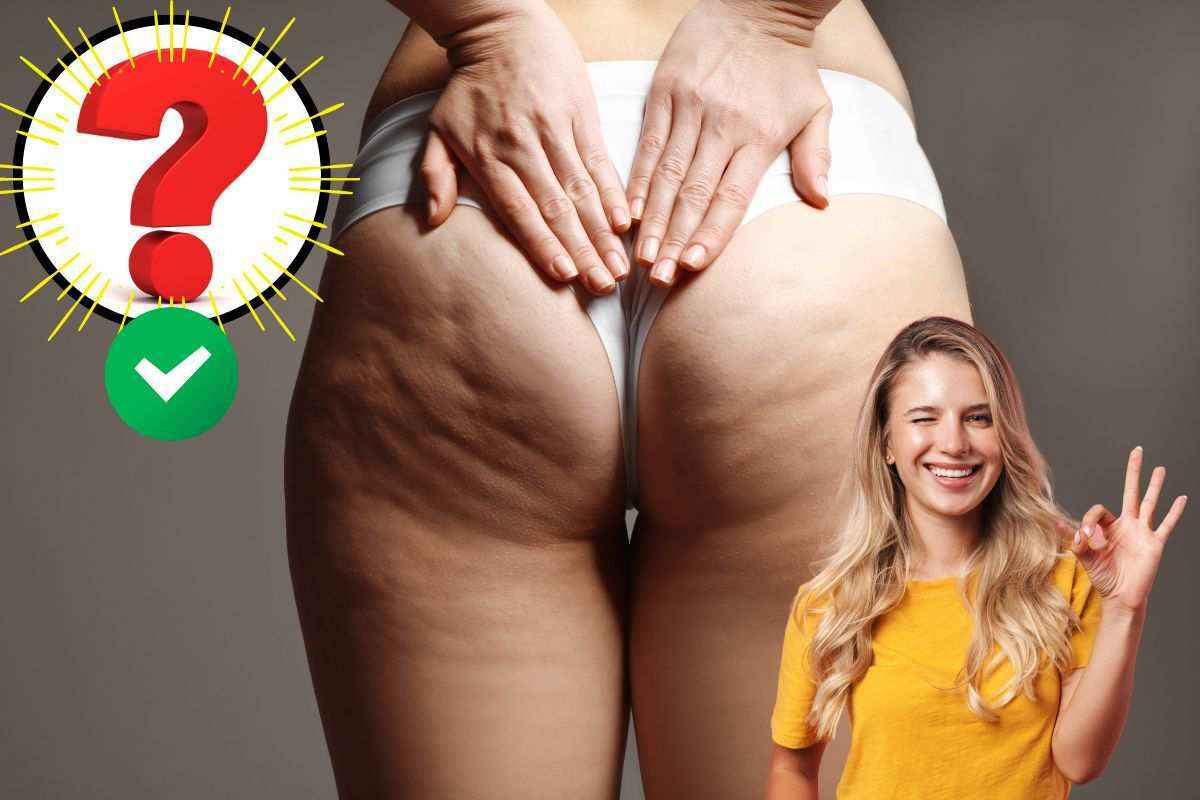 sbarazzarsi della cellulite