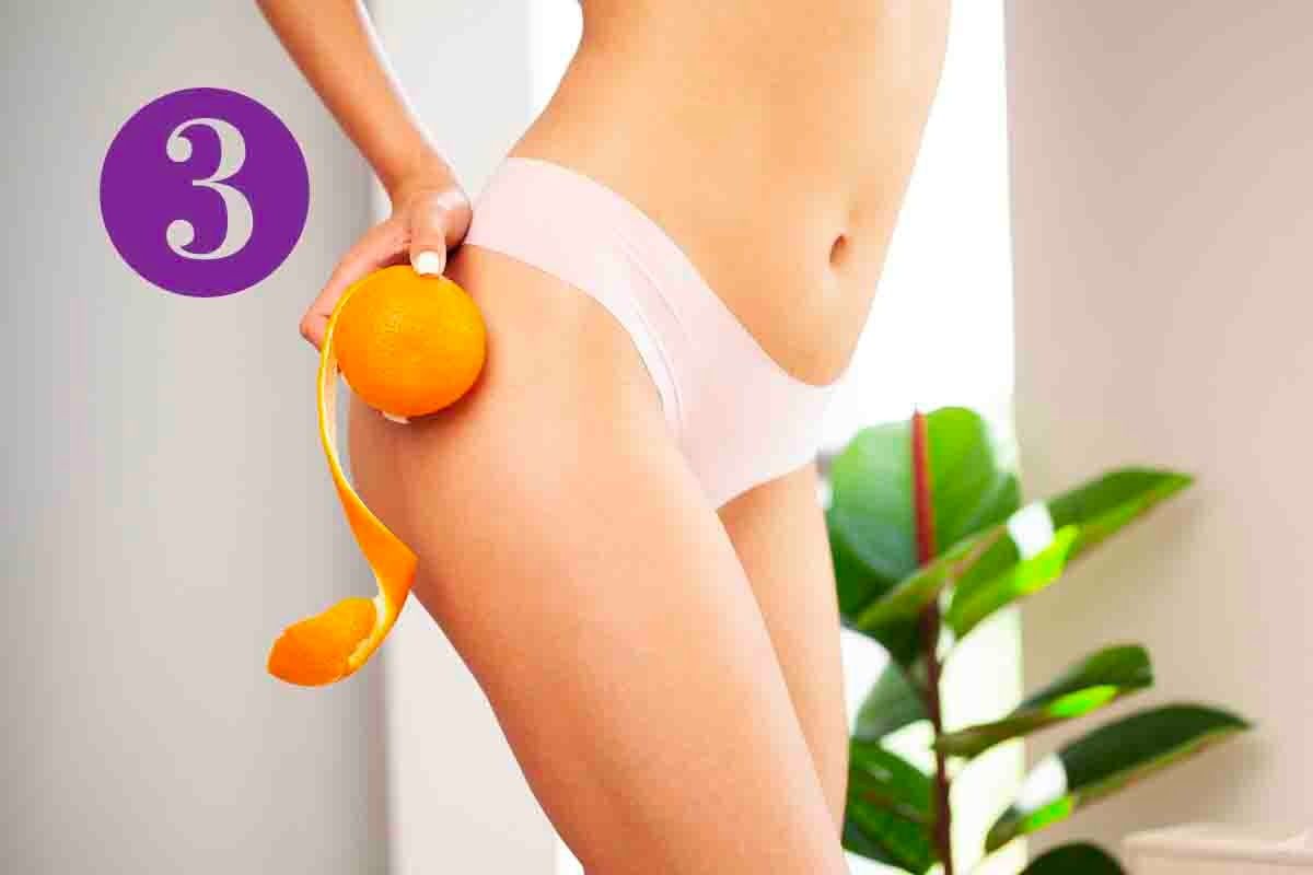 cellulite come trattarla