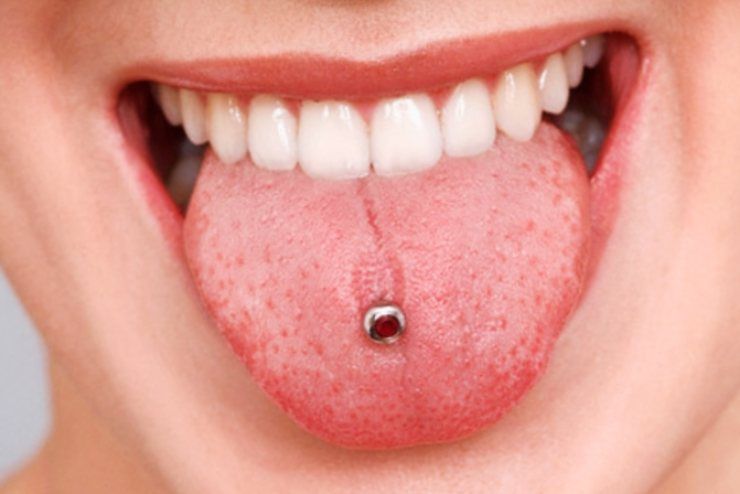 Il Piercing alla lingua danneggia i denti?