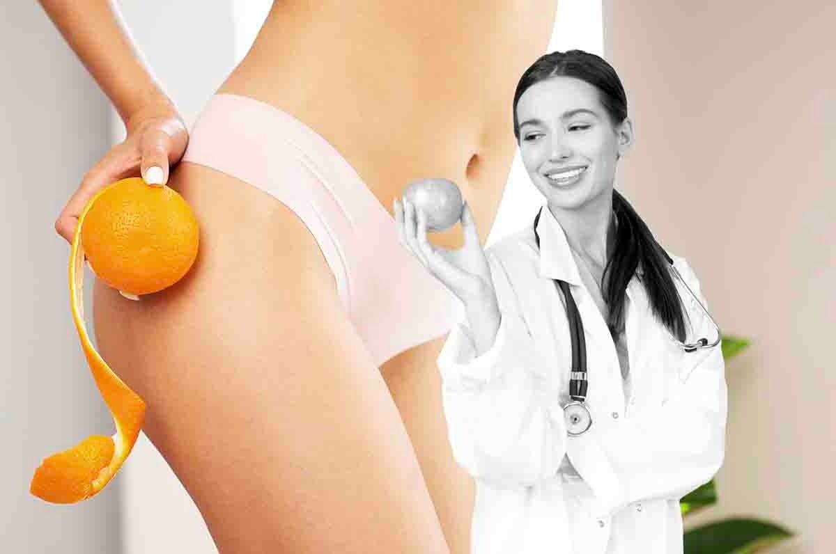 addio cellulite nutrizionista