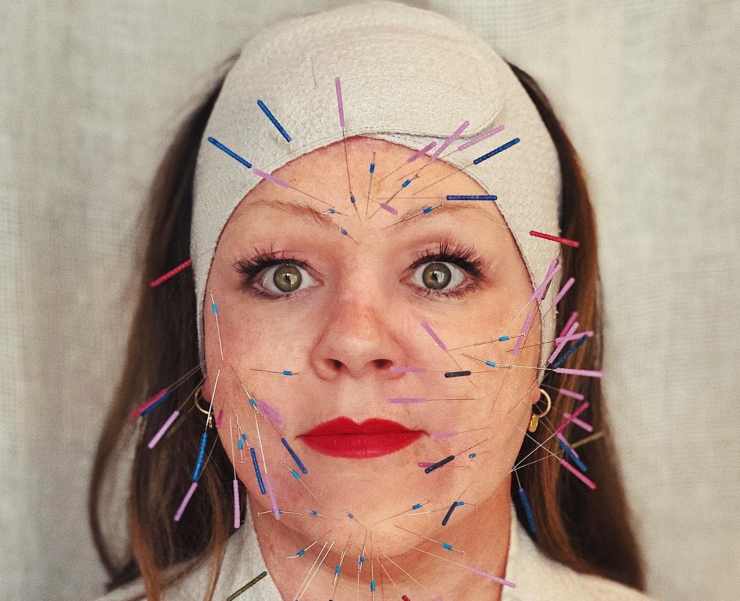 Snellire il viso: dall'agopuntura alla dieta